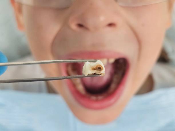 Best Cosmetic Emergency Dentistry in Vadnais Heights, MN